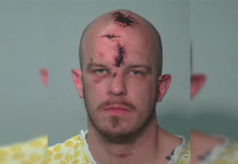 After Saturday morning stabbing and fire, Fort Wayne man charged with multiple felonies
