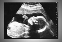 Report: more women coming to Illinois for abortions