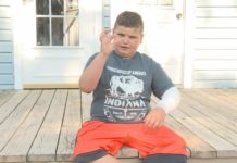 Boy survives serious dog attack at Jellystone Park in Marshall County