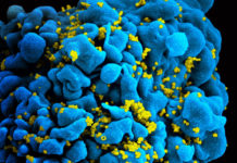 $26 million federal grant to boost HIV treatment in Indiana